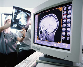 Brain-scan-278x225
