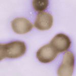 M-mycoides-jcvi-syn1