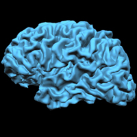 Brain_scan