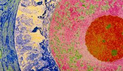 Cell1_13959_P6320050-Coloured_TEM_of_egg_cell_in_the_ovary-SPL