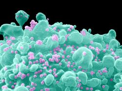 1_14422-M0500637-Coloured_SEM_of_a_T-cell_infected_with_AID