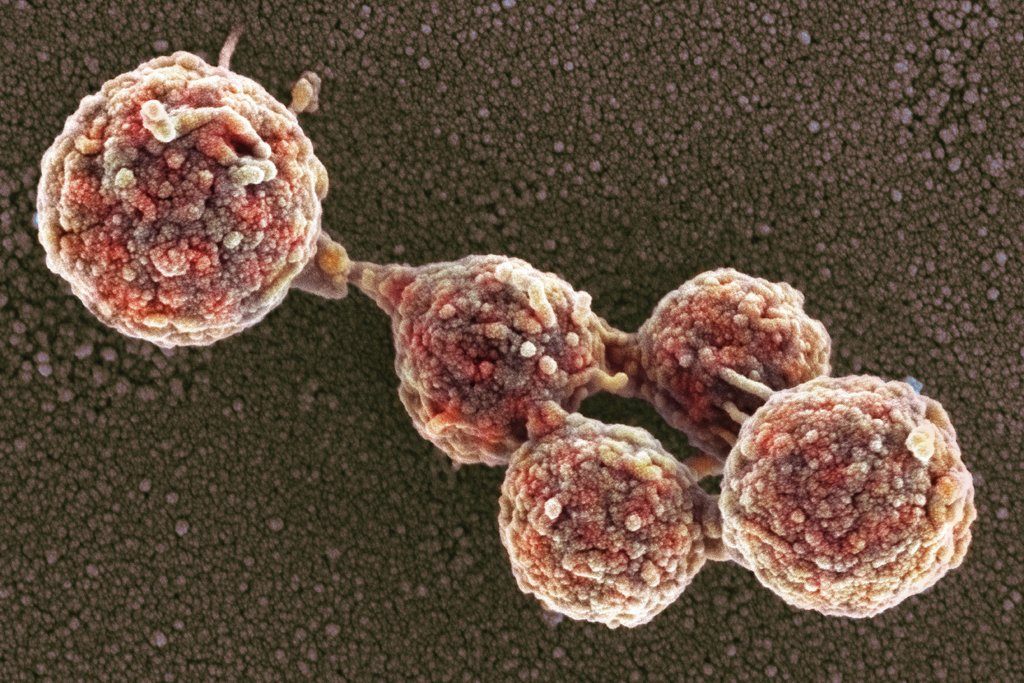 Scientists Created Bacteria With a Synthetic Genome. Is This Artificial ...