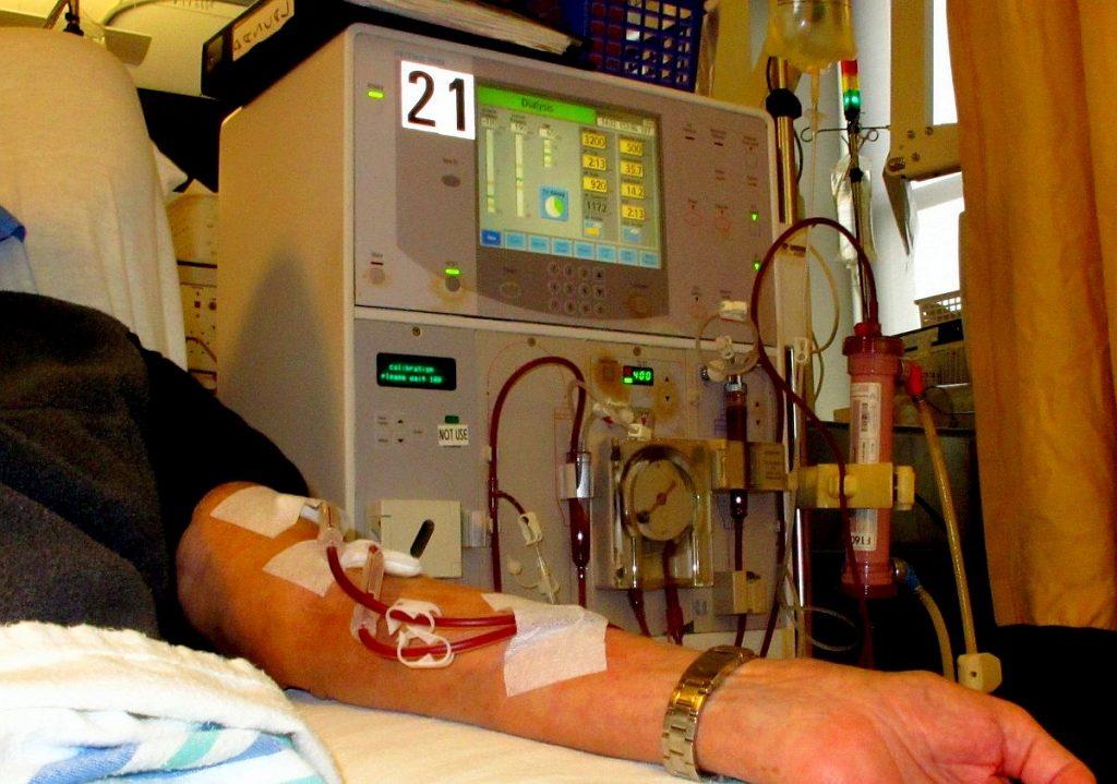 Arm hooked up to dialysis tubing