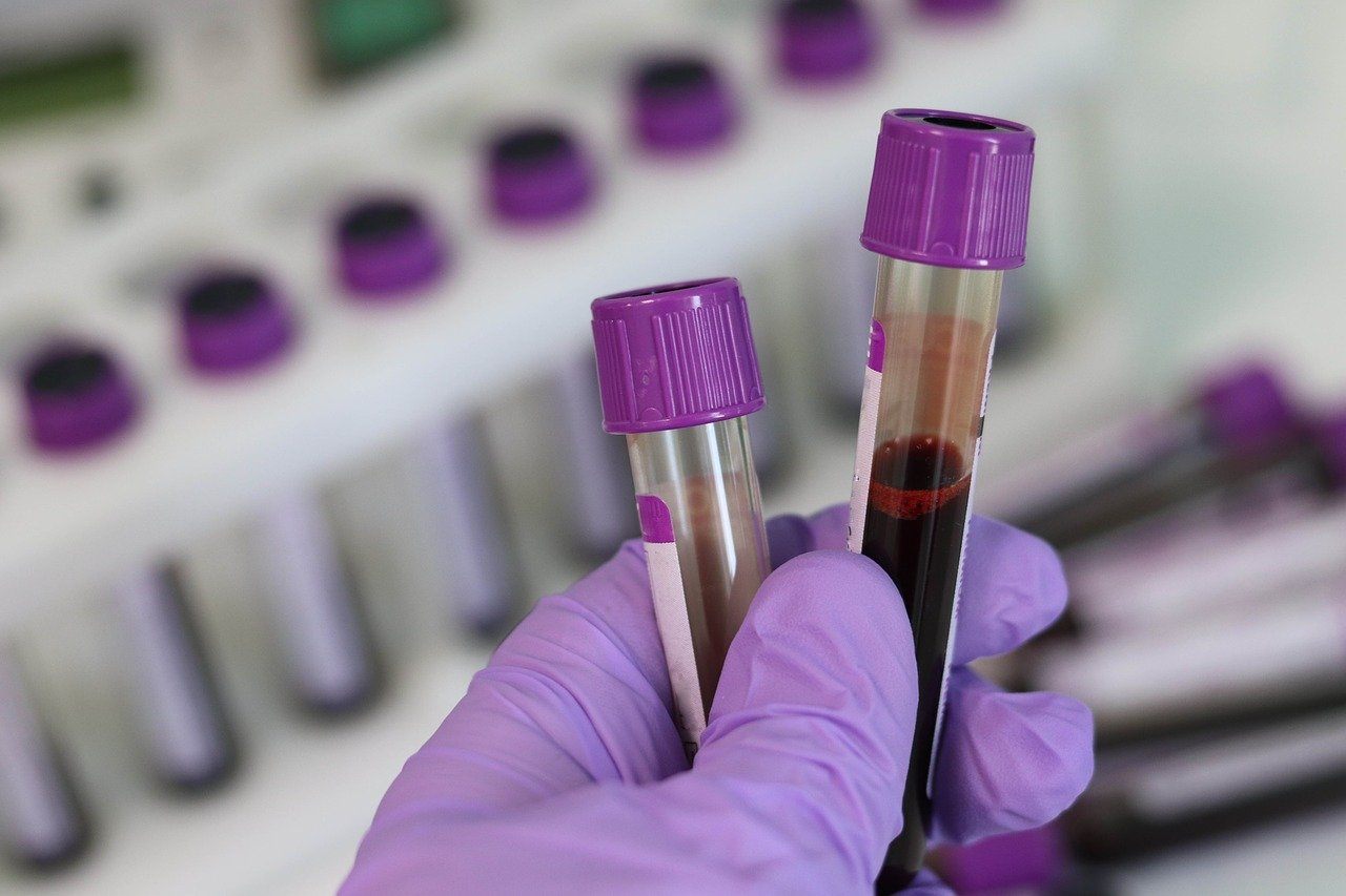 NHS to trial blood test that can detect over 50 cancer types - 3 Quarks ...