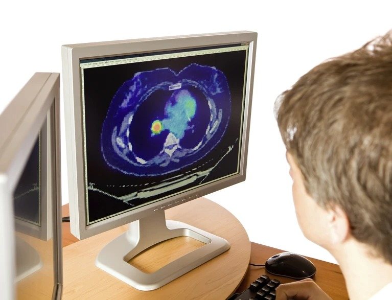 Cancer Detection Using Scanner Innovations to detect cancer at its origin - 3 Quarks Daily