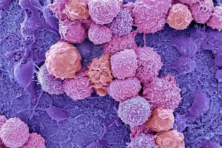 Human brain cells used as living AIs to solve mathematical equations ...