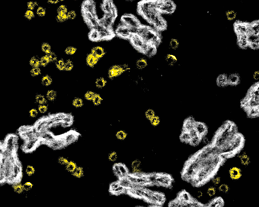 In the loop: odd rings of DNA in tumors - 3 Quarks Daily